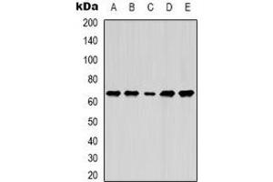 Western blot analysis of Lamin B1 expression in MCF7 (A), A549 (B), SKOV3 (C), mouse brain (D), mouse liver (E) whole cell lysates. (Lamin B1 antibody)