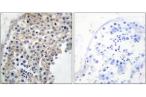 Immunohistochemistry analysis of paraffin-embedded human testis tissue, using Adrenergic Receptor alpha-2A Antibody.