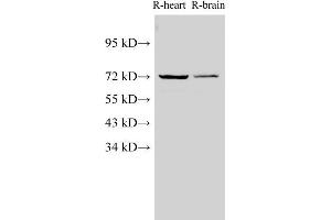 Western Blot analysis of Rat heart and Rat brain using Lamin B1 Polyclonal Antibody at dilution of 1:1000