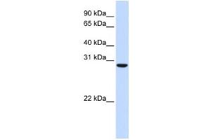 Western Blotting (WB) image for anti-Chromosome 18 Open Reading Frame 10 (C18orf10) antibody (ABIN2459873) (TPGS2 antibody)