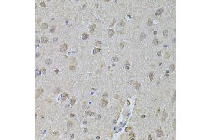 Immunohistochemistry of paraffin-embedded mouse brain using NME1 Antibody (ABIN5970089) at dilution of 1/200 (40x lens).