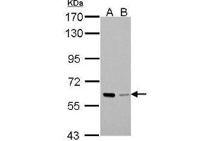WB Image Sample (30 ug of whole cell lysate) A: A431 B: HeLa 7. (PAK1 antibody  (Center))