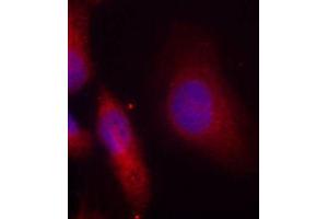 Immunofluorescence staining of methanol-fixed HeLa cells using Phospho-SRC-Y529 antibody (ABIN5969948). (Src antibody  (pTyr529))