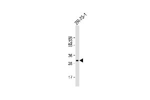 Anti-MYOGENIN Antibody (N-term) at 1:1000 dilution + ZR-75-1 whole cell lysate Lysates/proteins at 20 μg per lane. (Myogenin antibody  (N-Term))