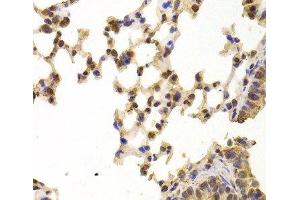 Immunohistochemistry of paraffin-embedded Mouse lung using PPP2R1B Polyclonal Antibody at dilution of 1:100 (40x lens). (PPP2R1B antibody)