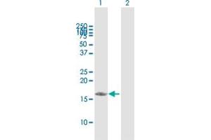 Western Blot analysis of PDRG1 expression in transfected 293T cell line by PDRG1 MaxPab polyclonal antibody. (PDRG1 antibody  (AA 1-133))