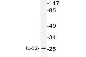 Western blot (WB) analyzes of IL-32 antibody in extracts from HepG2 cells. (IL32 antibody)