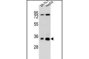 MTHFD2L Antibody (C-term) (ABIN655253 and ABIN2844851) western blot analysis in HepG2,ZR-75-1 cell line lysates (35 μg/lane). (MTHFD2L antibody  (C-Term))