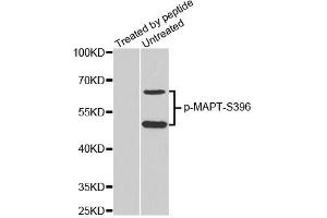 Western blot analysis of extracts from mouse brain tissue, using phospho-MAPT-S396 antibody (ABIN2987482). (MAPT antibody  (pSer396))