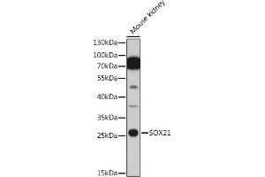Western blot analysis of extracts of Mouse kidney cells, using SOX21 antibody (ABIN7270574) at 1:1000 dilution. (SOX21 antibody  (AA 167-276))