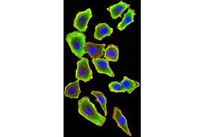 Immunocytochemistry (ICC) image for anti-TNF Receptor-Associated Factor 2 (TRAF2) (AA 39-188) antibody (ABIN5896378) (TRAF2 antibody  (AA 39-188))