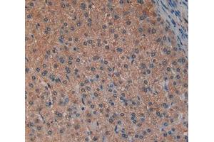 IHC-P analysis of Liver tissue, with DAB staining. (LAP antibody  (AA 320-519))