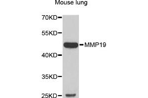 Western blot analysis of extracts of mouse lung, using MMP19 antibody (ABIN5974008) at 1/1000 dilution. (MMP19 antibody)
