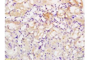 Formalin-fixed and paraffin embedded human kidney tissue labeled with Anti-Acetyl-Histone H1b(K53) Polyclonal Antibody , Unconjugated at 1:200, followed by conjugation to the secondary antibody and DAB staining (Histone H1 antibody  (acLys52))