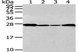 Gel: 12 % SDS-PAGE, Lysate: 40 μg, Lane 1-4: 293T, K562, Jurkat and 231 cell, Primary antibody: ABIN7128063(UCHL3 Antibody) at dilution 1/300 dilution, Secondary antibody: Goat anti rabbit IgG at 1/8000 dilution, Exposure time: 30 seconds (UCHL3 antibody)