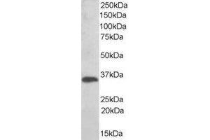 Western Blotting (WB) image for anti-Thioredoxin-Related Transmembrane Protein 1 (TMX1) (C-Term) antibody (ABIN2466410) (TMX1 antibody  (C-Term))