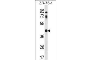 Western blot analysis in ZR-75-1 cell line lysates (35ug/lane). (CTSO antibody  (N-Term))