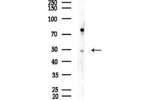anti-Abhydrolase Domain Containing 2 (ABHD2) (Internal Region) antibody