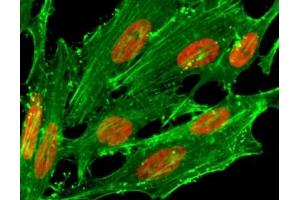 Immunocytochemistry (ICC) image for anti-H2A Histone Family, Member Z (H2AFZ) (acLys7) antibody (ABIN4953320)