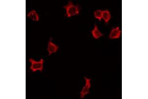 ABIN6268730 staining HepG2 by IF/ICC. (ITGA3 antibody)
