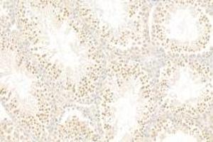 Immunohistochemistry analysis of paraffin-embedded mouse tumor using,MOG (ABIN7075362) at dilution of 1: 1500 (RANGRF antibody)