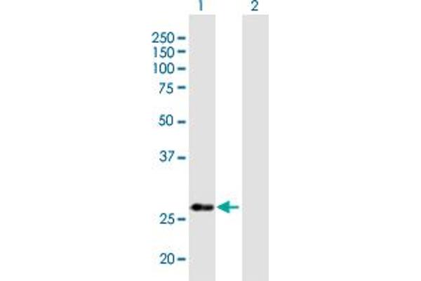 NUBP2 antibody  (AA 1-271)