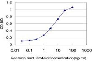 Detection limit for recombinant GST tagged TTR is approximately 1ng/ml as a capture antibody. (TTR antibody  (AA 21-147))