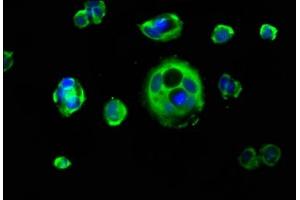 Immunofluorescence staining of MCF-7 cells with ABIN7157412 at 1:133, counter-stained with DAPI. (Cytokeratin 1 antibody  (AA 267-438))