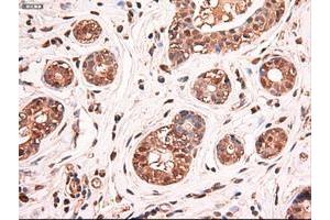 Image no. 13 for anti-Myc Proto-Oncogene protein (MYC) antibody (ABIN1497012) (c-MYC antibody)