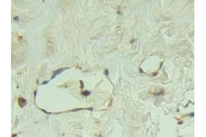 Immunohistochemistry (IHC) image for anti-P-Cadherin (CDH3) (AA 371-660) antibody (ABIN7437923)