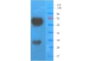 Western Blot using anti-VEGF antibody  Rat skin lysate was resolved on a 10% SDS PAGE gel and blots probed with  at 1. (Recombinant VEGF antibody)