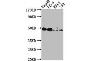 Western Blot Positive WB detected in: HepG2 whole cell lysate, PC-3 whole cell lysate, K562 whole cell lysate, 293 whole cell lysate All lanes: POGLUT1 antibody at 1:2000 Secondary Goat polyclonal to rabbit IgG at 1/50000 dilution Predicted band size: 47 kDa Observed band size: 47 kDa (POGLUT1 antibody  (AA 132-392))