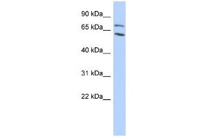 WB Suggested Anti-MTA2 Antibody Titration:  0. (MTA2 antibody  (N-Term))