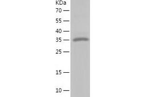 Western Blotting (WB) image for Calponin 1 (CNN1) (AA 1-297) protein (His tag) (ABIN7286410) (CNN1 Protein (AA 1-297) (His tag))