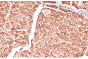Immunohistochemistry of paraffin-embedded Mouse heart using DES Polyclonal Antibody at dilution of 1:100 (40x lens). (Desmin antibody)