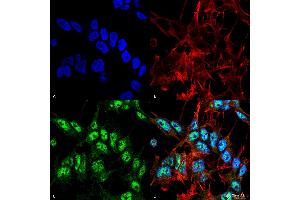 Immunocytochemistry/Immunofluorescence analysis using Rabbit Anti-Beclin 1 Polyclonal Antibody . (Beclin 1 antibody)