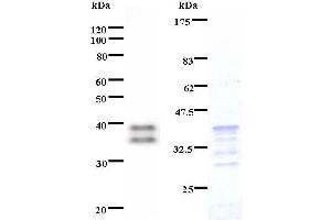 Left: HIVEP2 staining. (HIVEP2 antibody)