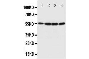 Western Blotting (WB) image for anti-Fascin (FSCN1) (AA 97-113), (N-Term) antibody (ABIN3044444) (Fascin antibody  (N-Term))