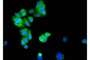 Immunofluorescent analysis of HepG2 cells using ABIN7146577 at dilution of 1:100 and Alexa Fluor 488-congugated AffiniPure Goat Anti-Rabbit IgG(H+L) (DREAM antibody  (AA 1-145))