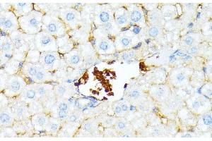 Immunohistochemistry of paraffin-embedded Mouse liver using SPTA1 Polyclonal Antibody at dilution of 1:100 (40x lens). (SPTA1 antibody)