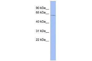 ZRSR2 antibody used at 1 ug/ml to detect target protein. (ZRSR2 antibody)