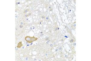 Immunohistochemistry of paraffin-embedded rat brain using MCCC2 antibody at dilution of 1:100 (x40 lens).