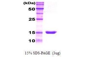 Figure annotation denotes ug of protein loaded and % gel used. (G-CSF Protein)