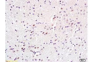 Formalin-fixed and paraffin embedded rat brain labeled with Anti-BS69/Adenovirus 5 E1A binding protein Polyclonal Antibody, Unconjugated (ABIN872692) at 1:200 followed by conjugation to the secondary antibody and DAB staining. (ZMYND11 antibody  (AA 501-602))
