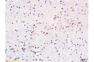 Formalin-fixed and paraffin embedded rat brain labeled with Anti-BS69/Adenovirus 5 E1A binding protein Polyclonal Antibody, Unconjugated (ABIN872692) at 1:200 followed by conjugation to the secondary antibody and DAB staining.