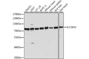 Western blot analysis of extracts of various cell lines, using SLC28 antibody (ABIN7270447) at 1:1000 dilution. (SLC28A2 antibody  (AA 350-450))