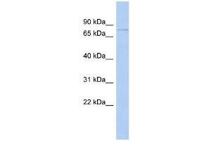 WB Suggested Anti-DHX58 Antibody Titration:  0. (DHX58 antibody  (N-Term))
