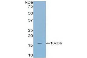 Western blot analysis of recombinant Mouse TPS. (TPSAB1 antibody  (AA 149-273))