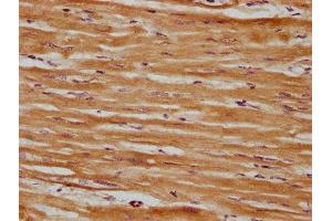 IHC image of ABIN7171044 diluted at 1:600 and staining in paraffin-embedded human heart tissue performed on a Leica BondTM system. (SRPX antibody  (AA 31-237))