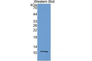 WB of Protein Standard: different control antibodies against Highly purified E. (MMP12 ELISA Kit)